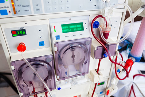 Peristaltic Pump